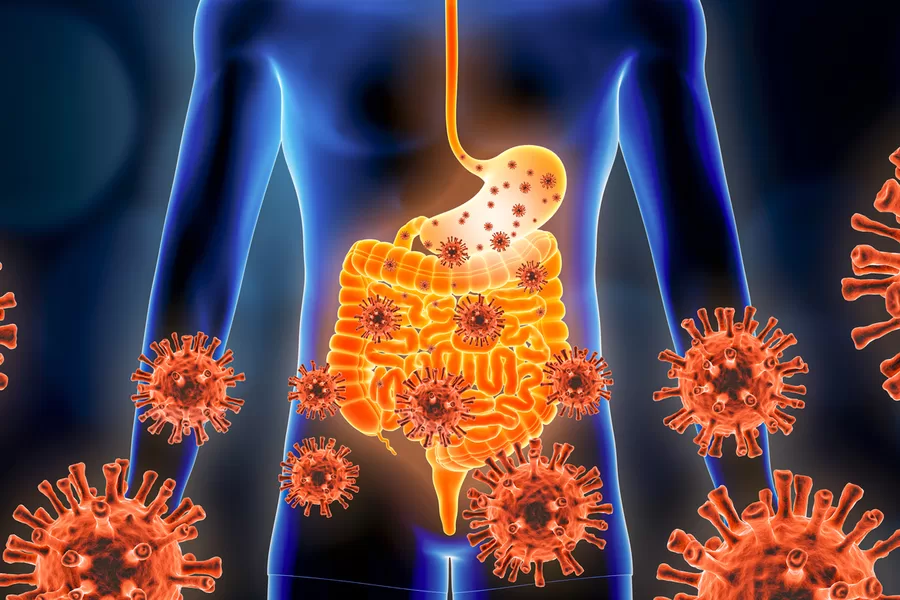 Read more about the article Popular Digestive System Infections