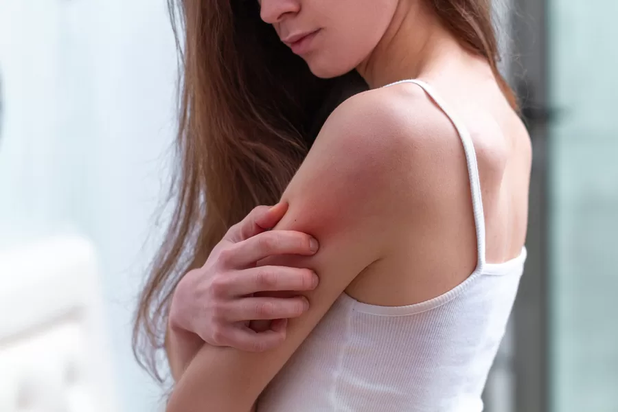 Read more about the article Common Skin Infections Guide
